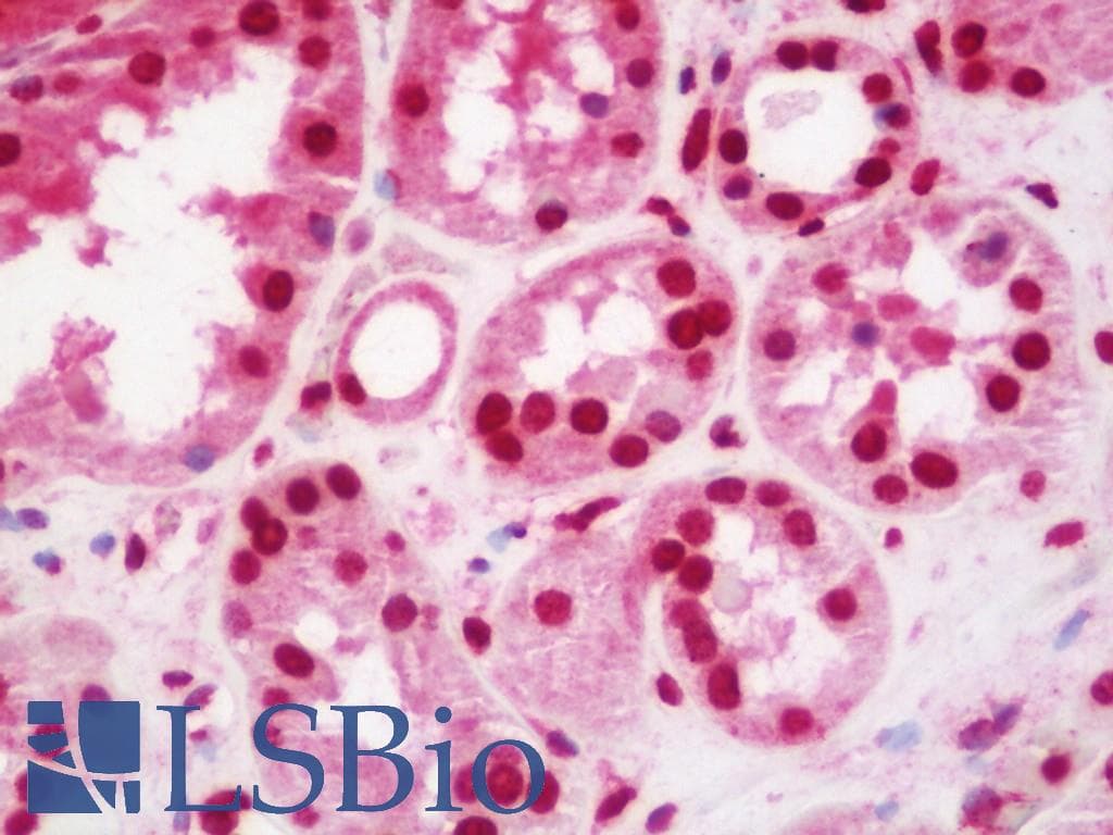 IHC-plus™ Polyclonal Rabbit anti-Human NKX3-1 Antibody (aa118-145, IHC, WB)