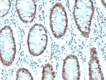 MSH6 Antibody (clone MSH6/3085)