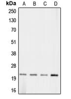 IHC-plus™ Polyclonal Rabbit anti-Human CLDN11 / Claudin 11 Antibody (C-Terminus, IHC, WB)