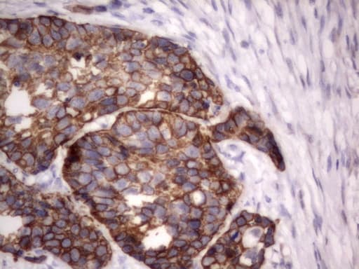 Acidic Cytokeratin Antibody (clone 7F10)