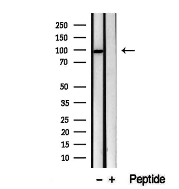 Polyclonal Rabbit anti-Human VPS16 Antibody (IHC, IF, WB)