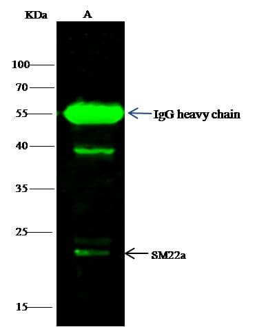 TAGLN / Transgelin / SM22 Antibody (Preservative Free)