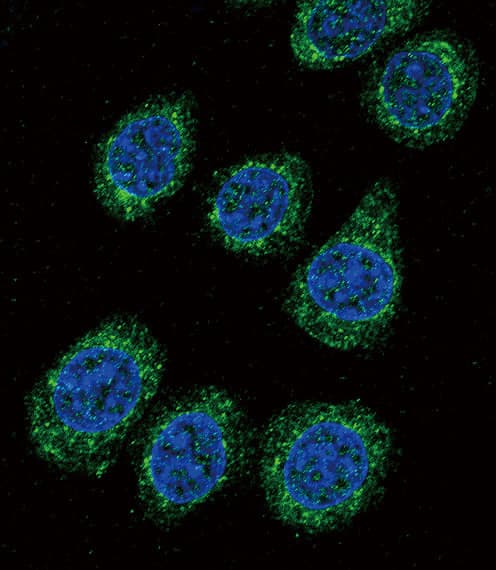 Polyclonal Rabbit anti-Human CYP3A5 Antibody (aa476-502, IHC, IF, WB)