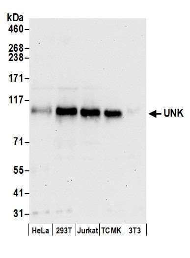 UNK Antibody (aa760-810)