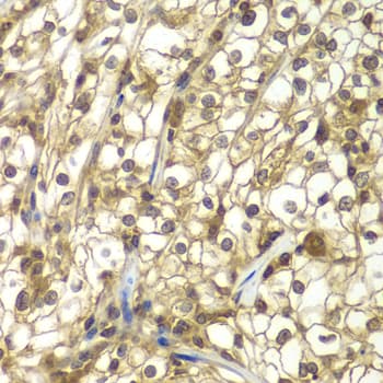 SULT2B1 / Sulfotransferase 2B1 Antibody