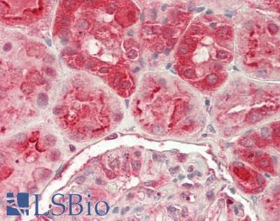 IHC-plus™ GGA1 Antibody (clone 3F11)