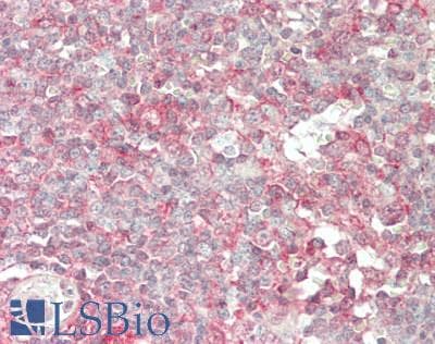 IHC-plus™ Monoclonal Mouse anti-Human DDX58 / RIG-1 / RIG-I Antibody (clone ABM4H29, aa1-220, IHC, WB)