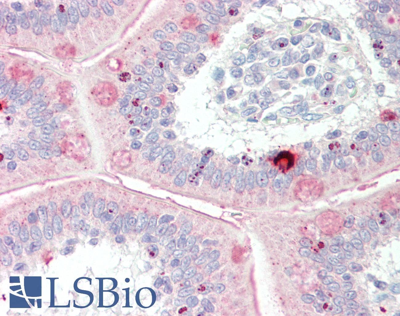 MYBL1 / A-MYB Antibody (aa553-602)