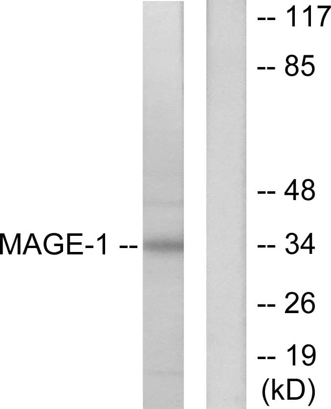 PathPlus™ Polyclonal Rabbit anti-Human MAGEA1 / MAGE 1 Antibody (aa260-309, IHC, WB)