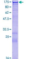 Human HDAC9 Protein (Recombinant GST)