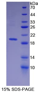 Human MME / CD10 Protein (Recombinant His)