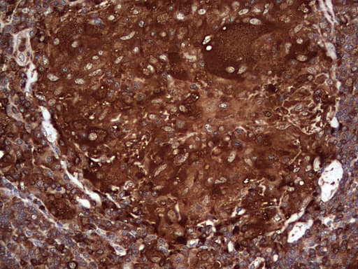PKM2 Antibody (clone OTI12D5, Carrier-free)