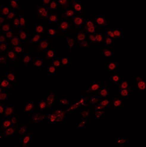 Polyclonal Rabbit anti-Human ZMYND8 / RACK7 Antibody (IF, WB)