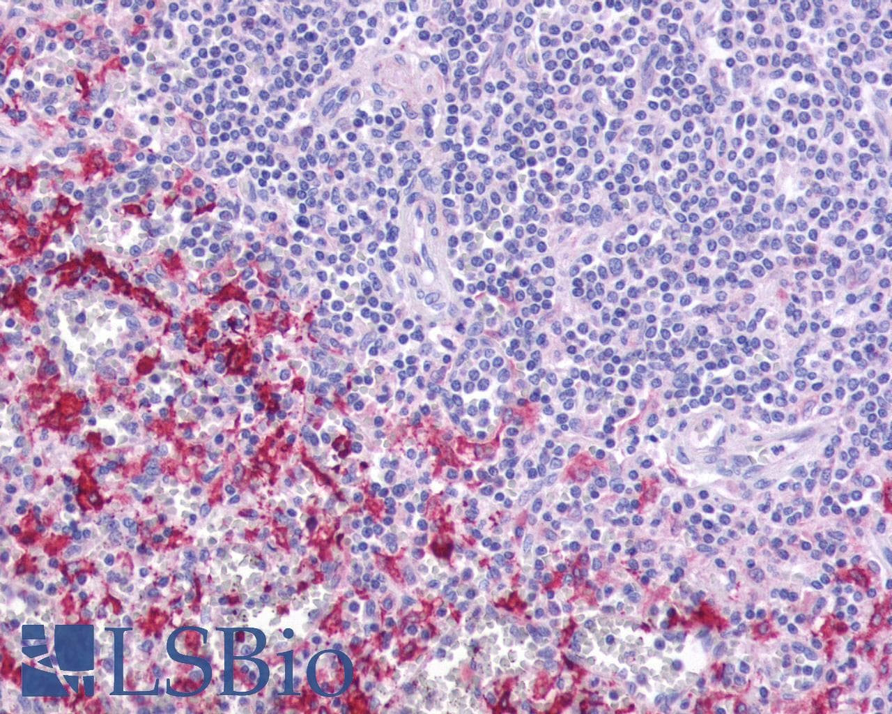 IHC-plus™ Polyclonal Rabbit anti-Human HCAR3 / GPR109B / HM74 Antibody (N-Terminus, IHC)