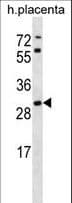 STARD4 Antibody (aa8-37)