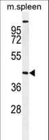 STK32A Antibody (aa1-30)