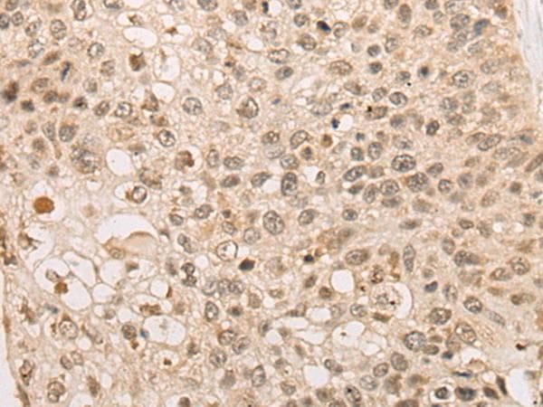 CAPN15 / SOLH Antibody