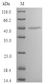 Human MAGEA1 / MAGE 1 Protein (Recombinant DDK,C-terminus)