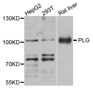 Polyclonal Rabbit anti-Human PLG / Plasmin / Plasminogen Antibody (IHC, IF, WB)