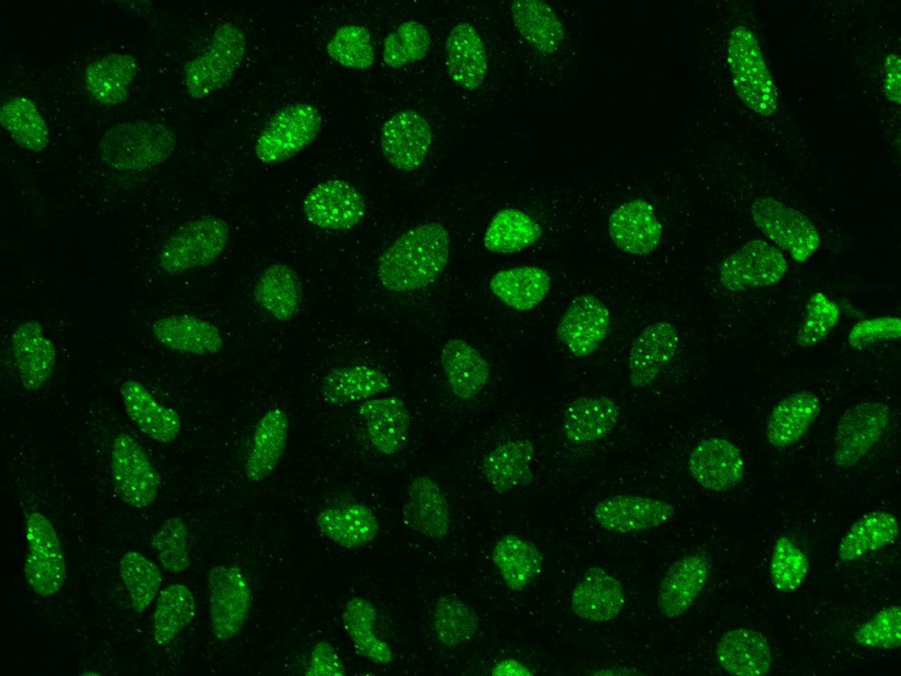 Polyclonal Rabbit anti-Human SP100 Antibody (IHC, IF)