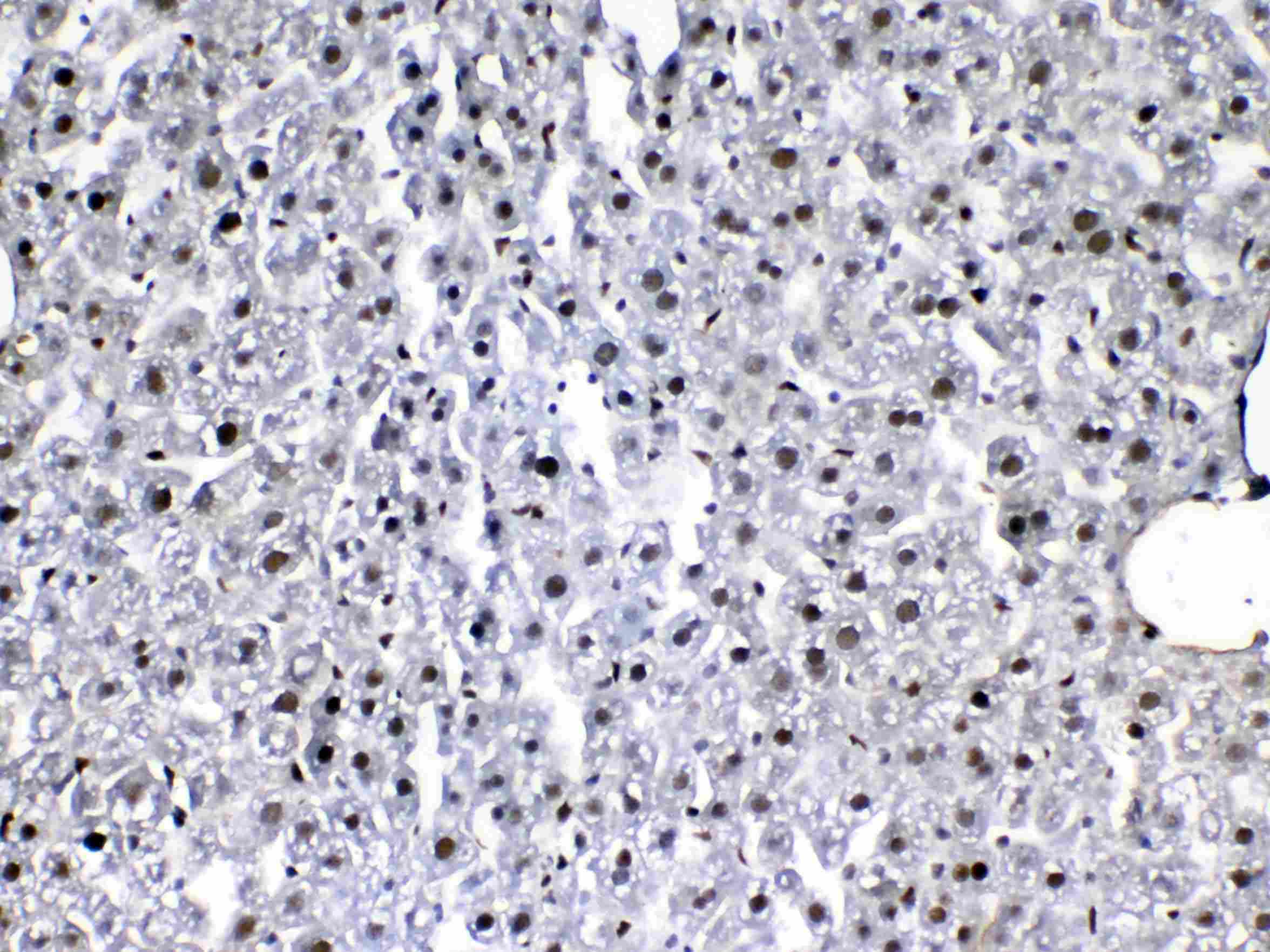 Polyclonal Rabbit anti-Human FLT4 / VEGFR3 Antibody (IHC, WB)