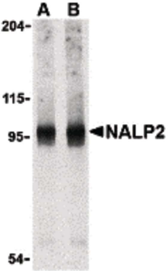 IHC-plus™ Polyclonal Rabbit anti-Human NLRP2 / NALP2 Antibody (IHC, WB)