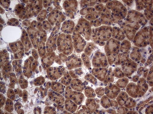 Monoclonal Mouse anti-Human ARAF / ARAF1 / A-RAF Antibody (clone OTI2G9, aa145-365, IHC, WB)