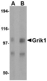 IHC-plus™ Polyclonal Rabbit anti-Human GRIK1 / GLUR5 Antibody (IHC, IF, WB)