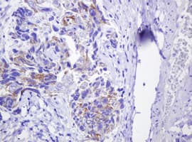 CTNND1 / p120 Catenin Antibody (clone OTI1G4, Carrier-free)