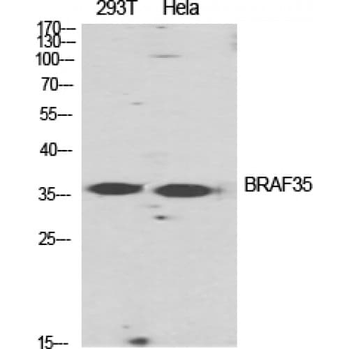 HMG20B / BRAF35 Antibody (10-90 aa, N-terminal)