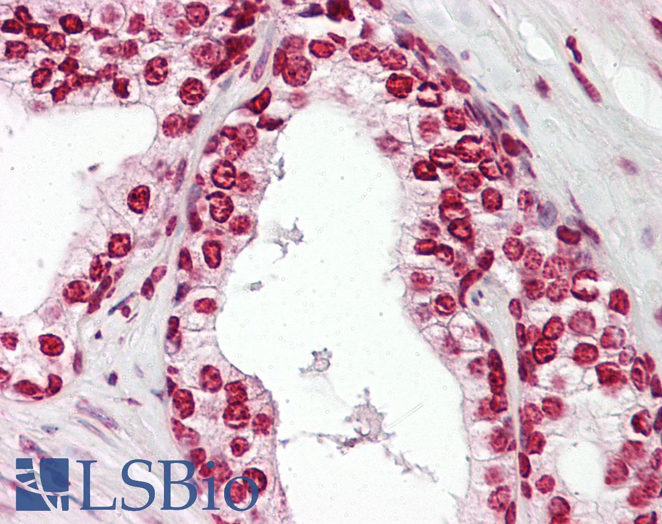 Polyclonal Rabbit anti-Human MKX Antibody (aa191-240, IHC, WB)