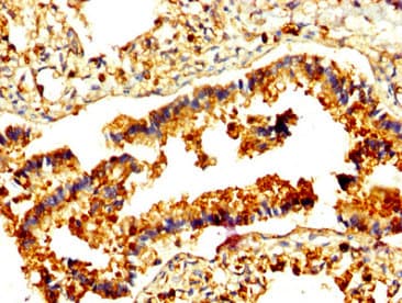 Polyclonal Rabbit anti-Human RAMP2 Antibody (IHC, IF)