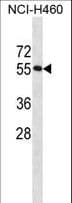 RBM45 / DRB1 Antibody (aa447-476)