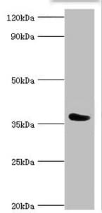 CD84 / SLAMF5 Antibody (aa22-225)