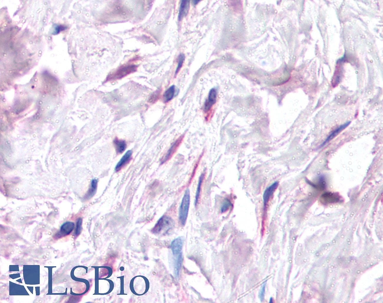 Polyclonal Rabbit anti-Human SDF1 / CXCL12 Antibody (C-Terminus, IHC, WB)