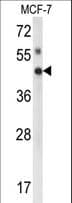 Polyclonal Rabbit anti-Human IPMK Antibody (aa300-329, WB)