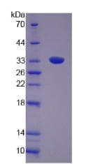 Human UTRN / Utrophin Protein (Recombinant His, N-Terminal)