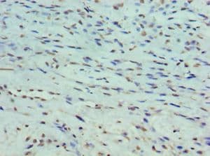 PPP1R1B / DARPP-32 Antibody (aa1-168)