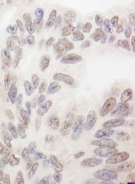 Polyclonal Rabbit anti-Human RBM12 Antibody (aa625-675, IHC, WB)
