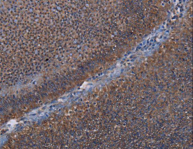 Polyclonal Rabbit anti-Human P3H3 / LEPREL2 Antibody (IHC, WB)