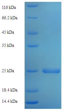 Human SDF2 Protein (Recombinant His)
