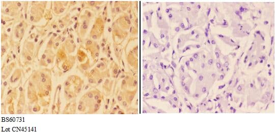 Polyclonal Rabbit anti-Human ANKRD20A3 Antibody (IHC, WB)