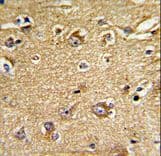 Polyclonal Rabbit anti-Human IMMT / Mitofilin Antibody (aa438-467, IHC, WB)