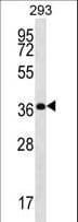 OR10H5 Antibody (aa245-273)
