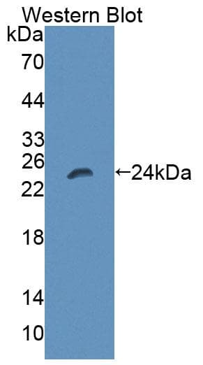 LIG1 / DNA Ligase 1 Antibody (aa484-663)