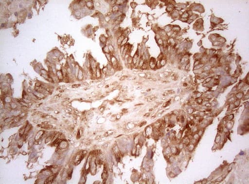 AHSA1 / AHA1 Antibody (aa1-203, clone OTI1D2)