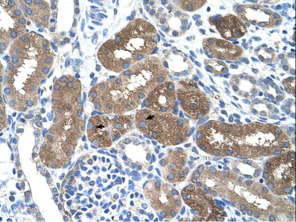 SOCS1 Antibody (aa21-70)