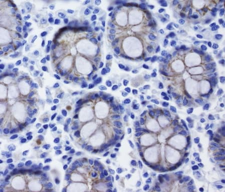 CDH1 / E Cadherin Antibody (clone UMAB184)