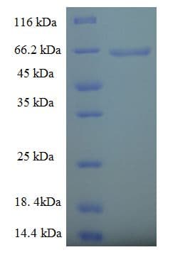 Human PLD4 / Phospholipase D4 Protein (Recombinant His-SUMO)