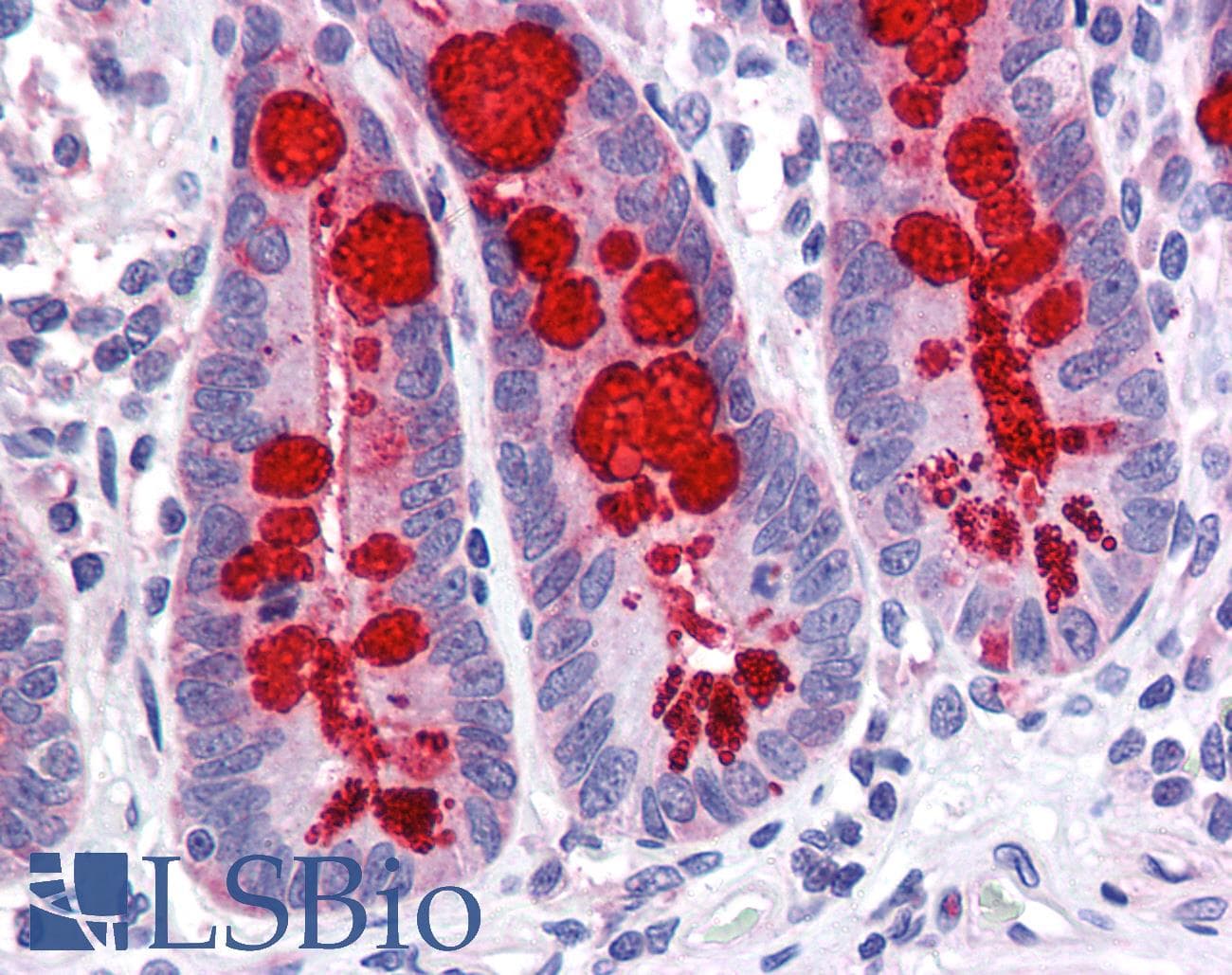 IHC-plus™ Monoclonal Mouse anti-Human SLC9A3R1 / NHERF1 / EBP50 Antibody (clone 2B7, IHC, WB)